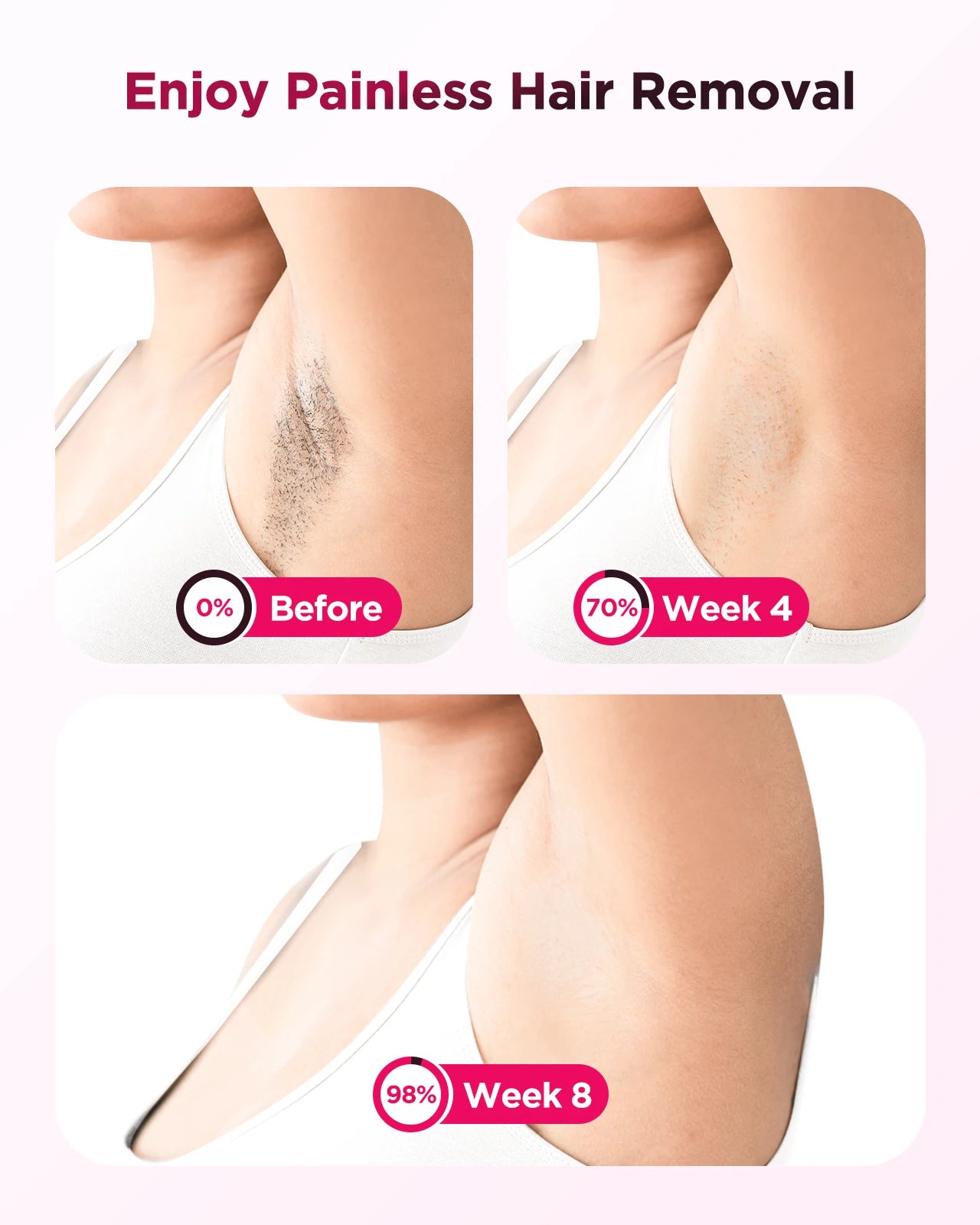 Totmizby IPL Laser Epilator Hair Remover